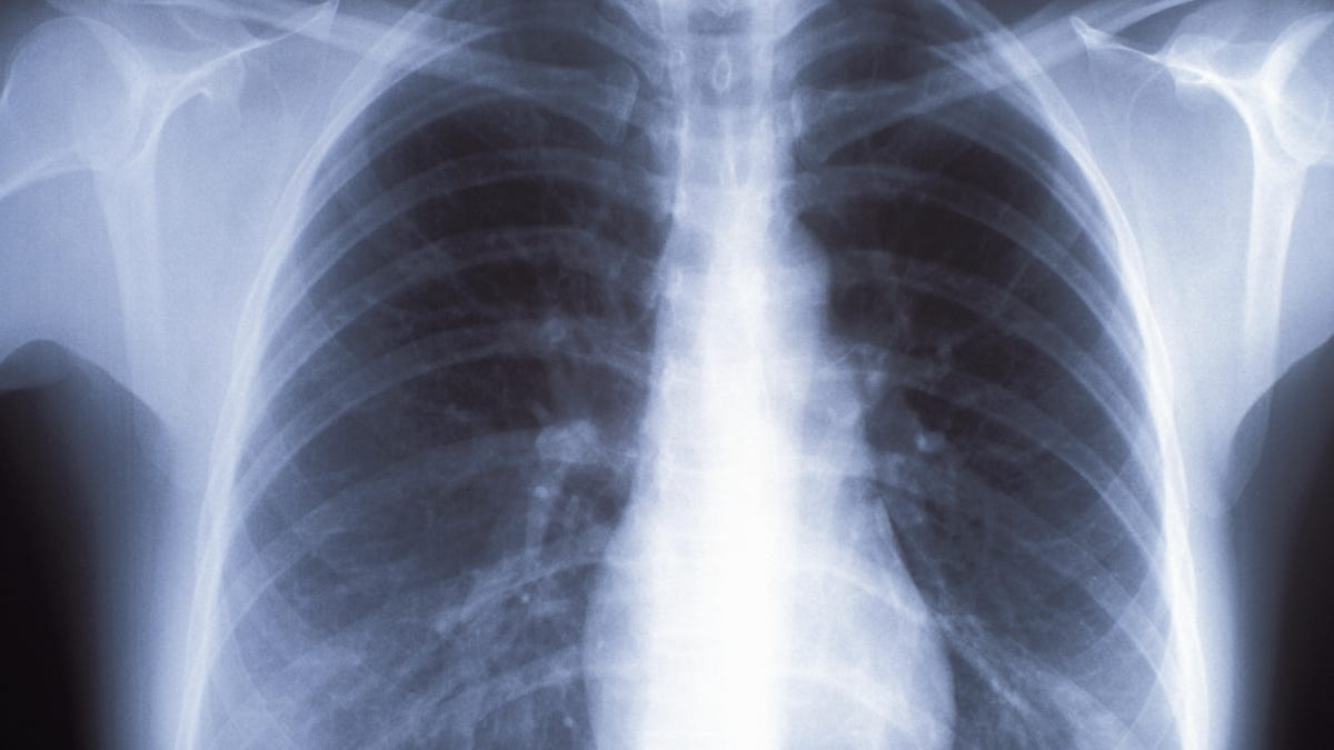 gettyimages-200482591-001