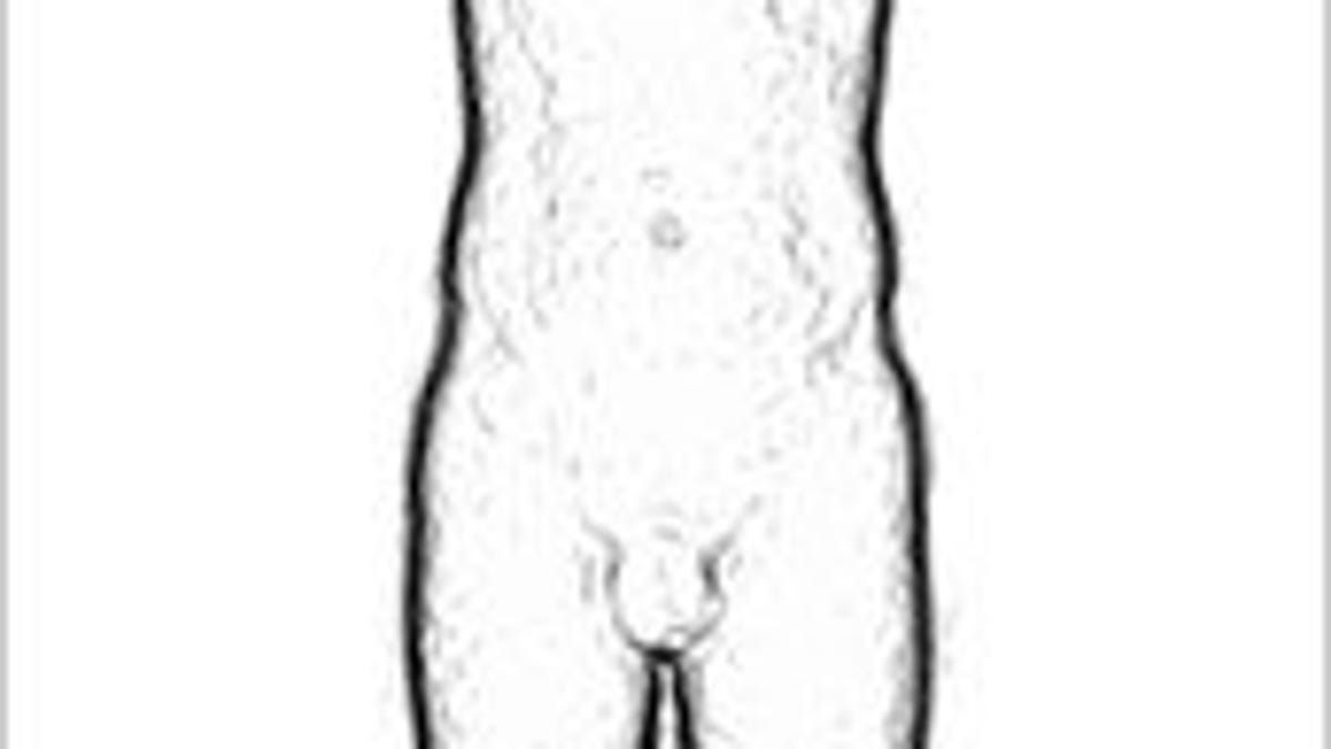 TSA's X-ray backscatter scanning with "privacy filter"