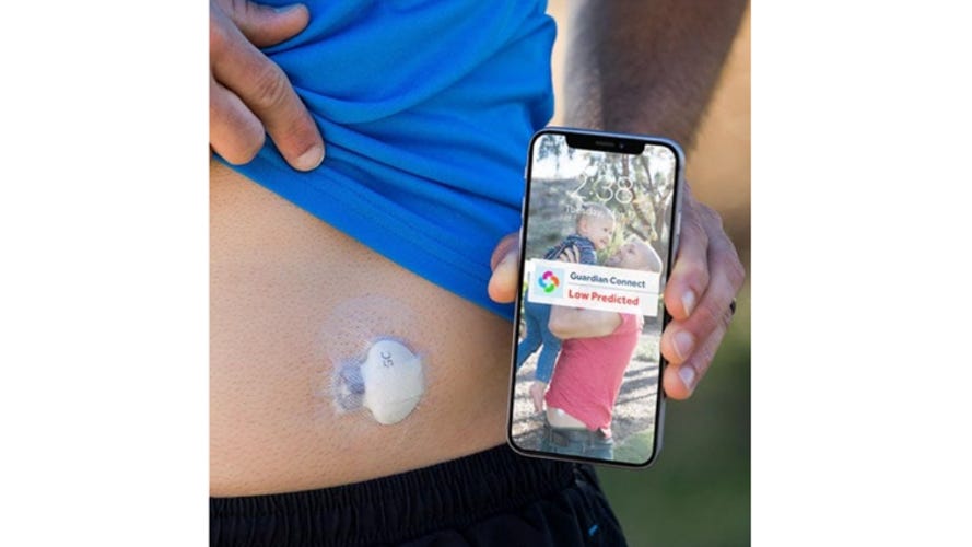 Guardian Connect blood glucose monitoring system