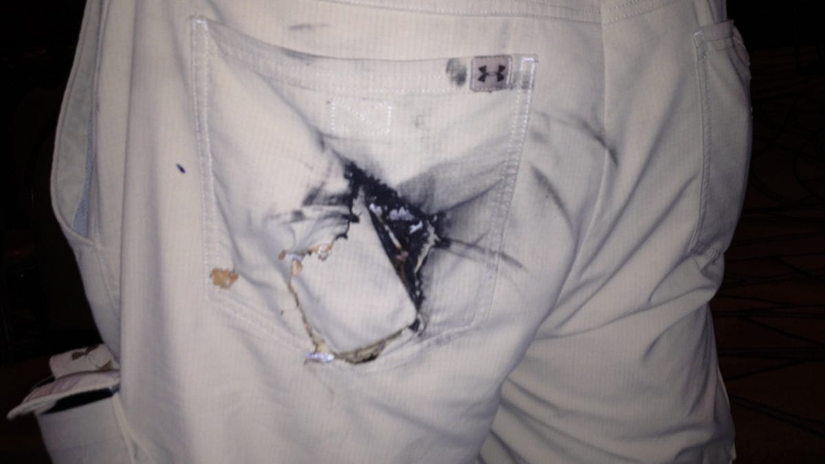 Defcon attendee shows CNET his charred backside after his cell phone battery spontaneously caught fire and seared a hole through his pants pocket.