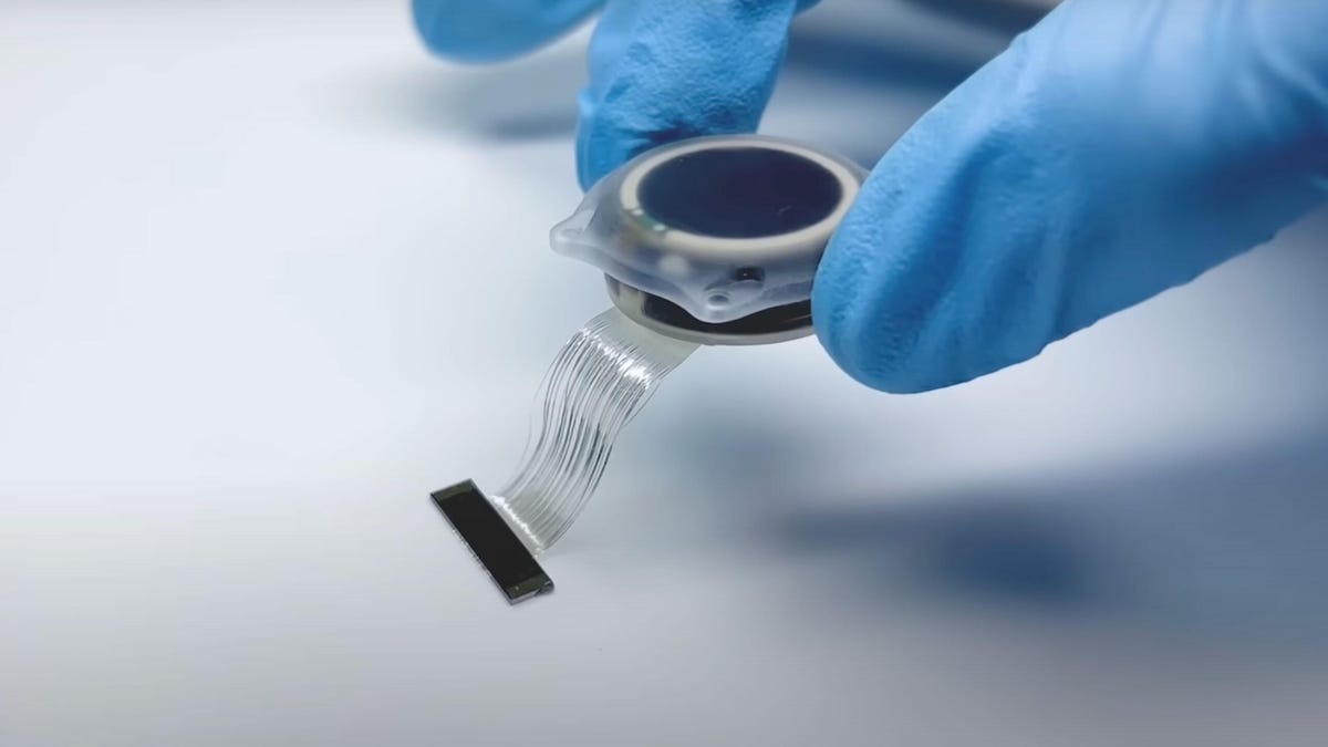 A close-up photo of the Neuralink Telepathy brain implant, a cylindrical device the width of a coin but significantly thicker, with a number of thin electrodes leading out of one side