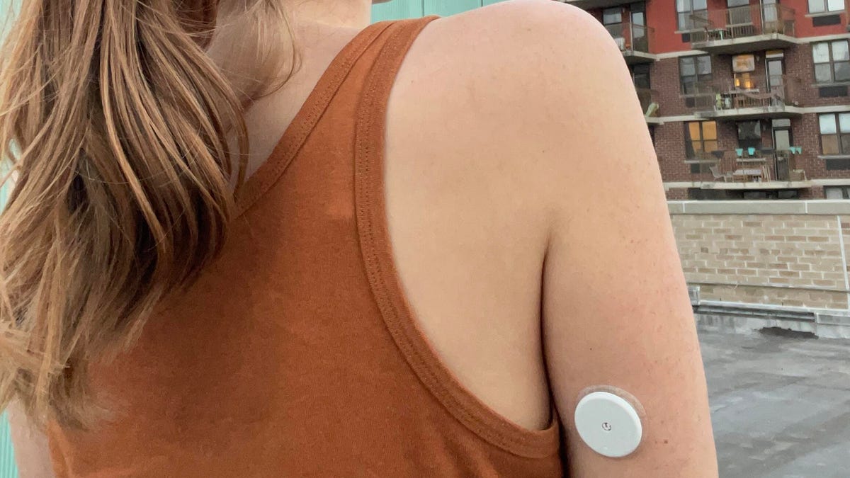 A person wearing a CGM on the back of her arm