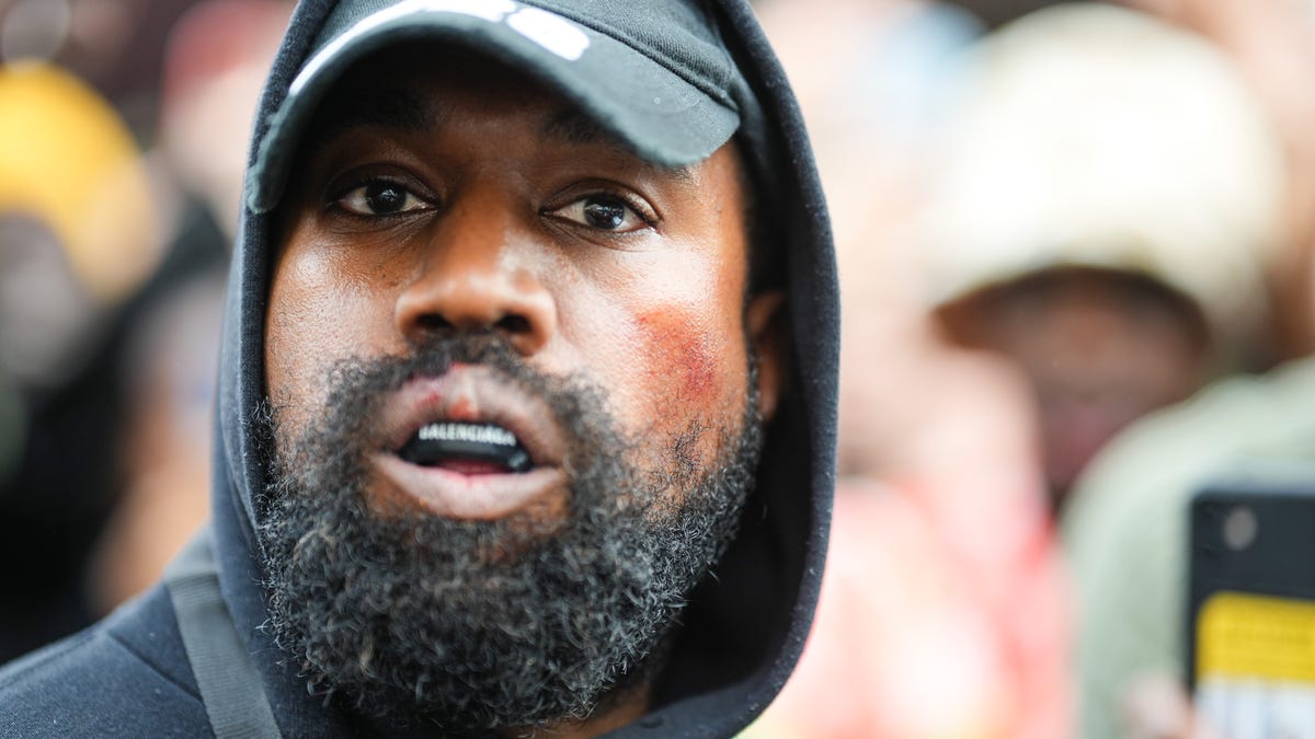 Kanye West in a baseball cap and hooded sweatshirt, with a Balenciaga boxing mouthguard