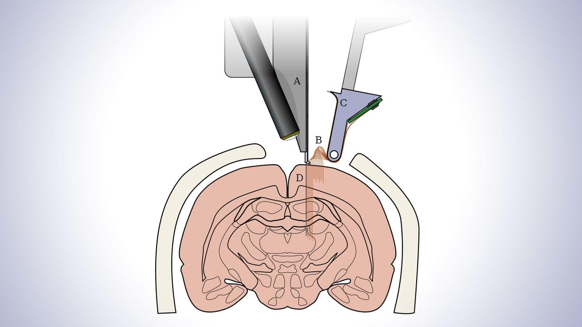Researchers associated with Elon Musk's Neuralink startup have proposed a sewing machine-like system to implant flexible electrodes to establish a communication link between brains and computers.