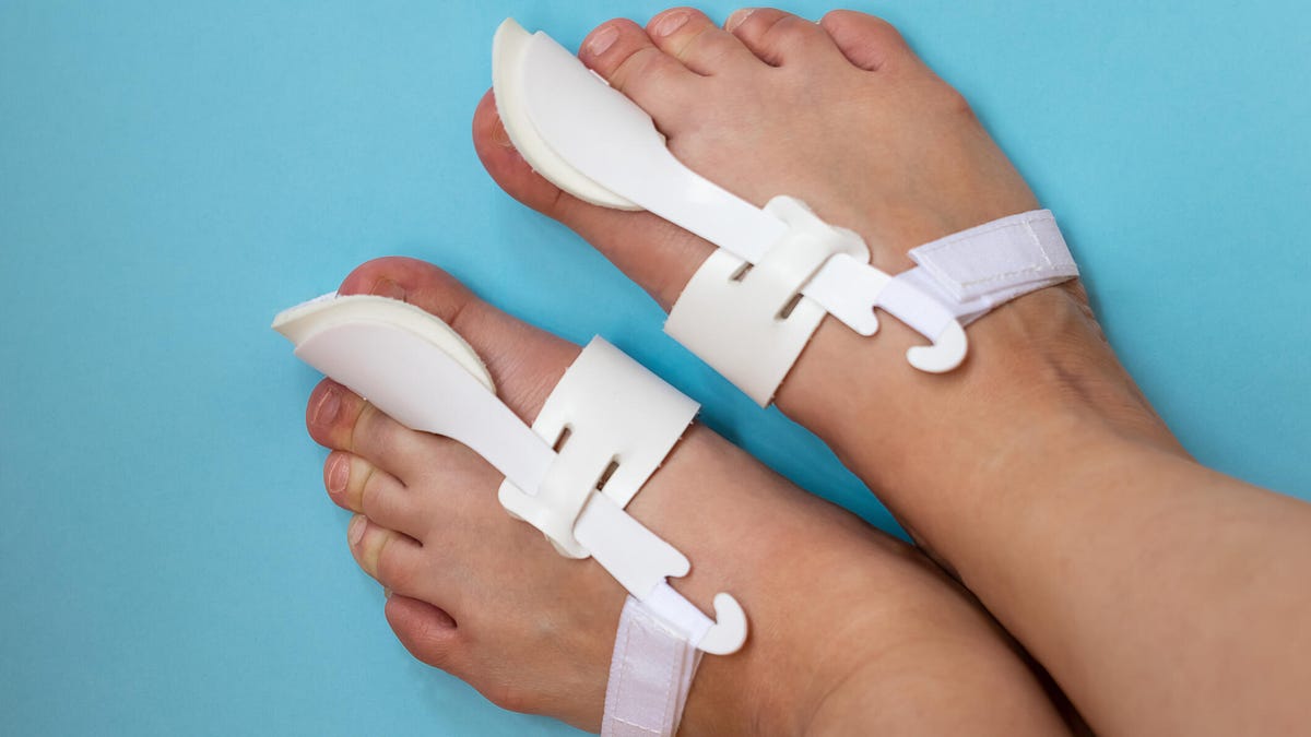 White bunion correctors wrapping around two feet and their big toes over a bright blue background.